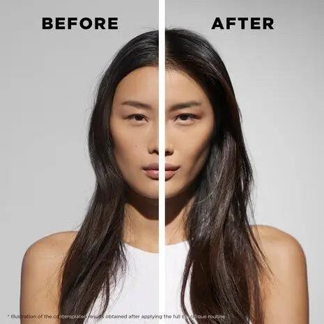 Before and after skincare results on woman's face showcasing clear skin improvements.