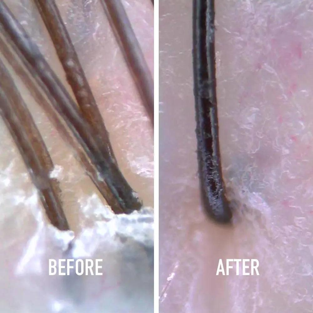 Before and after close-up images of hair follicles showing scalp treatment results.