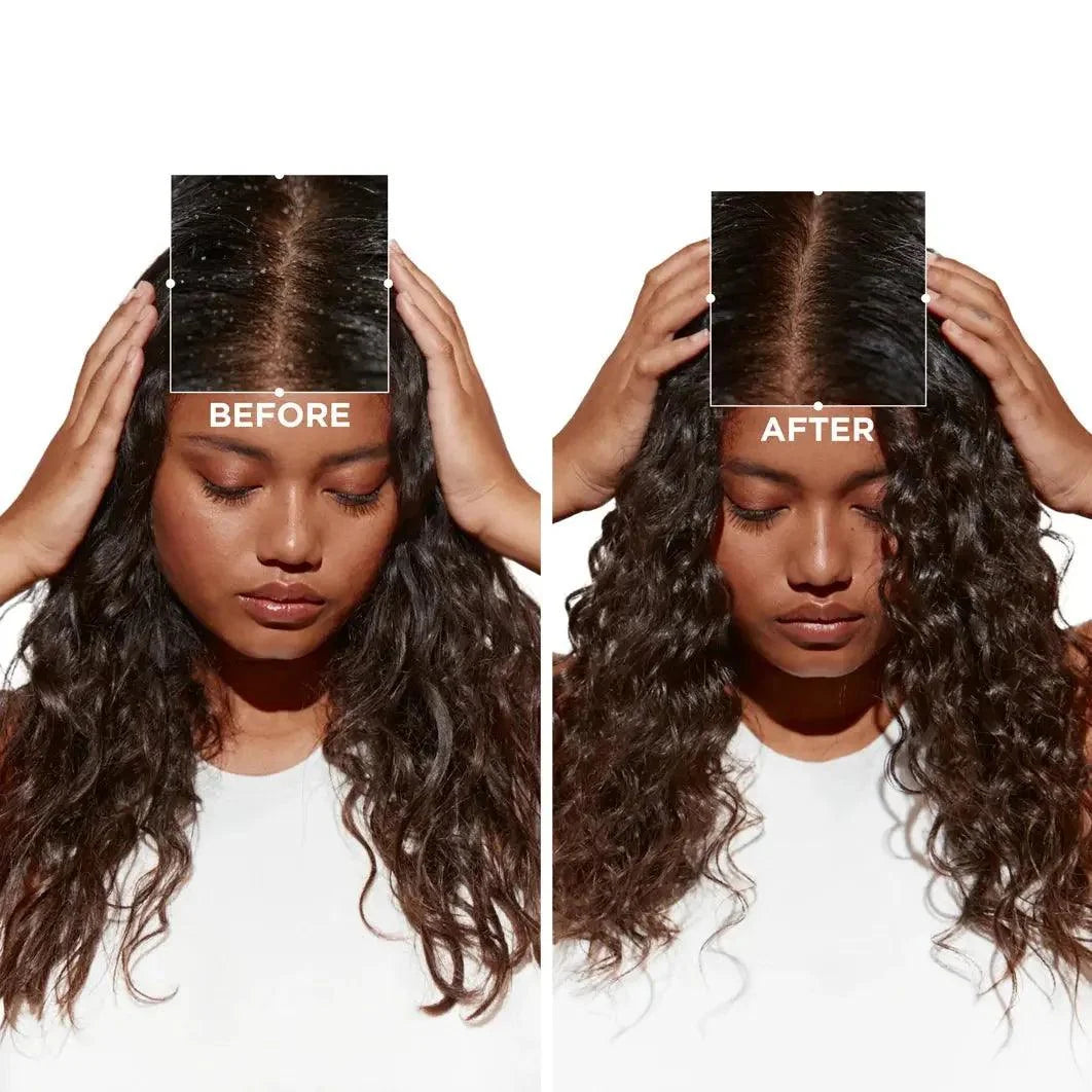 Before and after photo showing the transformation of hair using Symbiose Sérum Nuit Intensif for damaged hair.